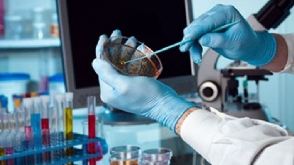 ABD'de Anthrax Virüsü Krizi