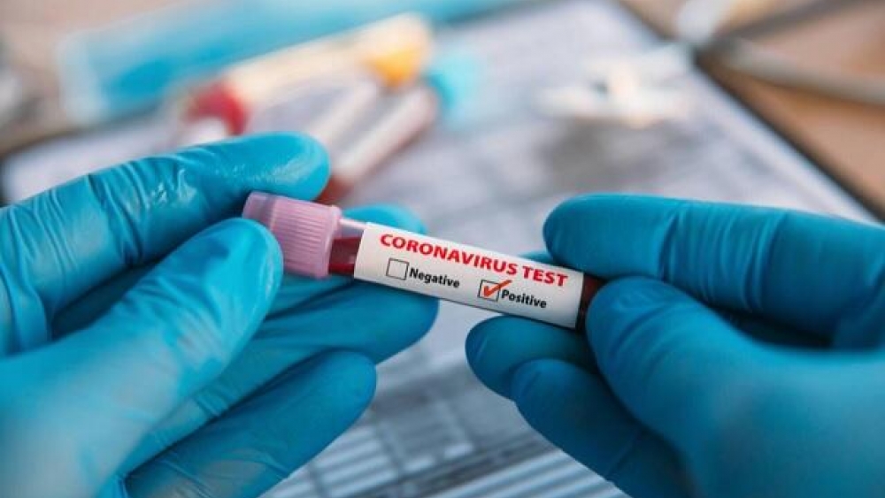 Günlük vakalar 32.381 artarken koronavirüs ölümleri 14.316'ya ulaştı