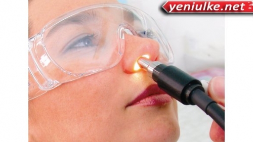 Allerjik Rırinit Nedir Tedavi Yöntemleri Nasıldır!